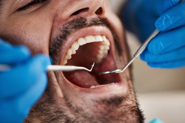 Best Emergency TMJ Treatment in Bryan, OH
